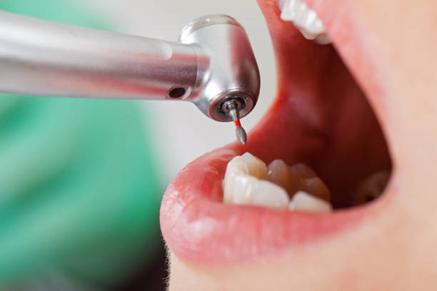 Best Emergency Broken Tooth Repair in North Baltimore, OH